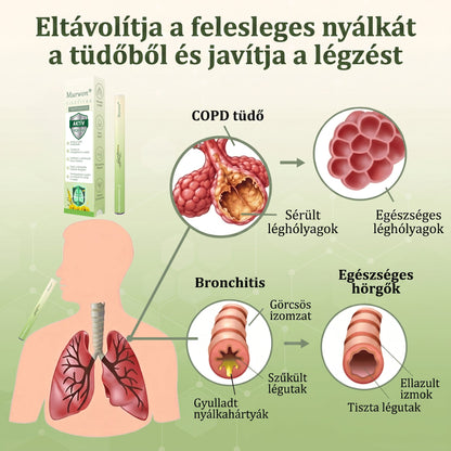 🇭🇺 High-Quality Hungarian Product with Domestic Shipping 🥇 Murwon® Herbal Lung-Cleansing Diffuser 🧄(👨‍⚕️ Effective Help for Cough, Sore Throat, Shortness of Breath, Mucus, Nasal Congestion, Bronchitis, Allergy Symptoms and Lung Problems) ❤️