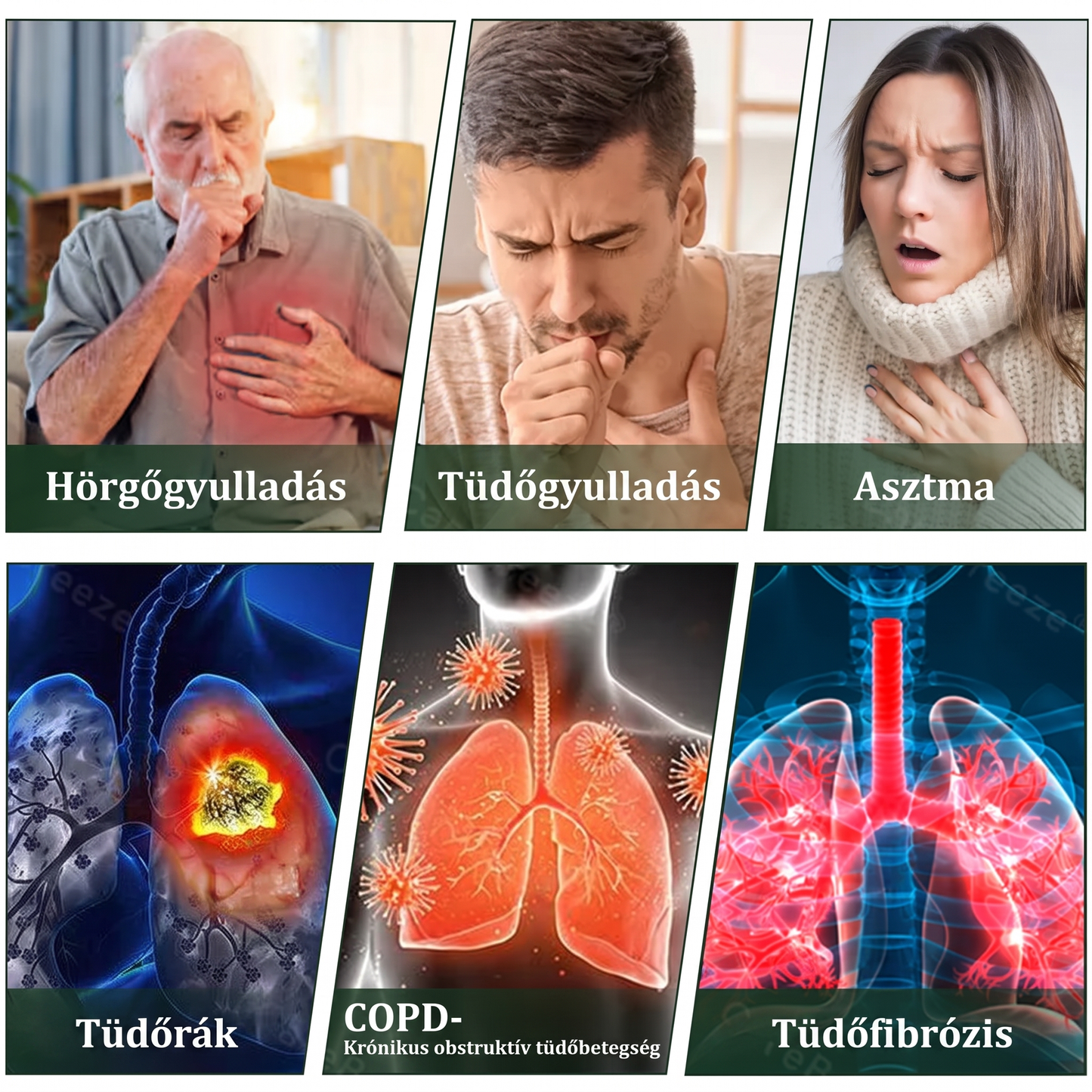 🇭🇺 High-Quality Hungarian Product with Domestic Shipping 🥇 Murwon® Herbal Lung-Cleansing Diffuser 🧄(👨‍⚕️ Effective Help for Cough, Sore Throat, Shortness of Breath, Mucus, Nasal Congestion, Bronchitis, Allergy Symptoms and Lung Problems) ❤️