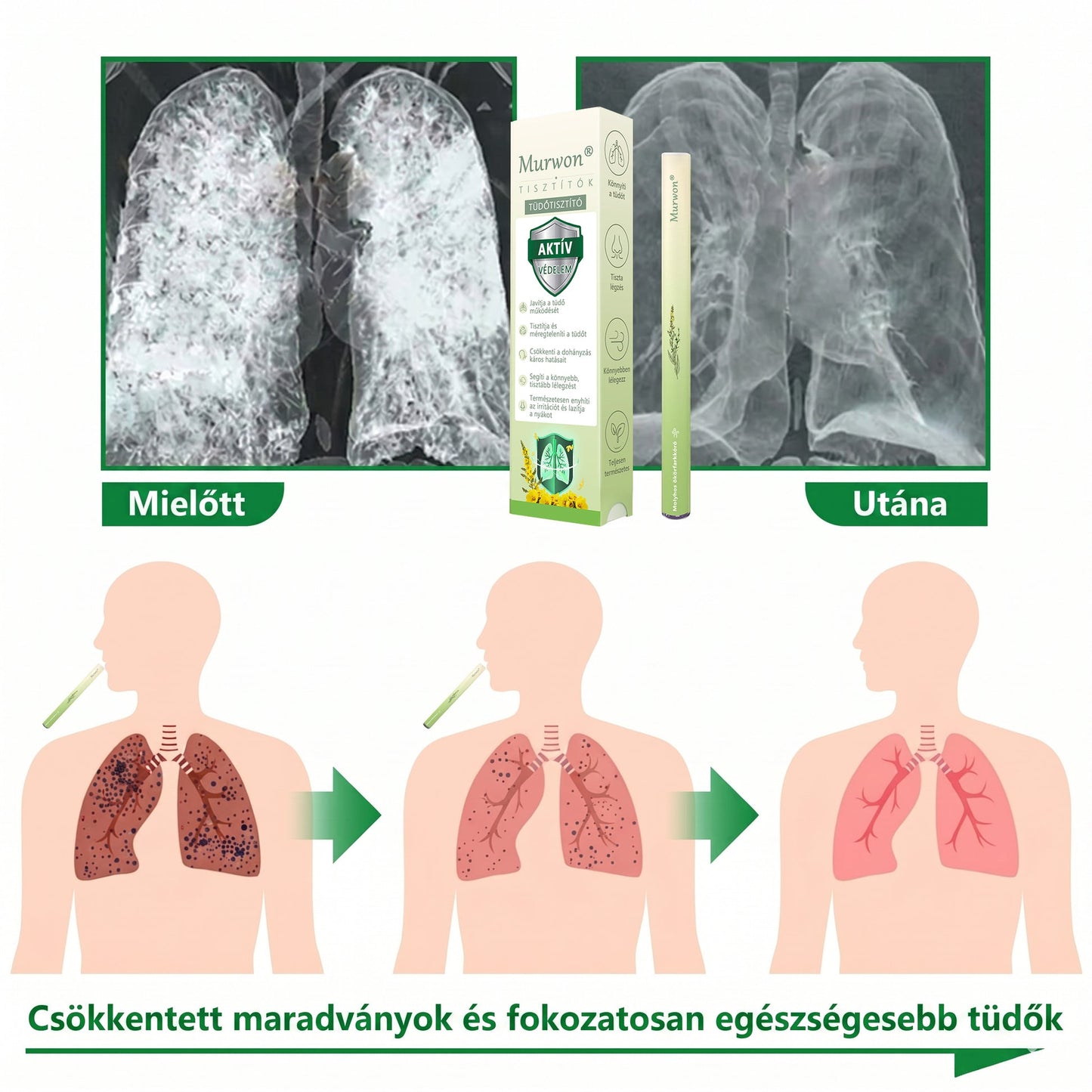 🇭🇺 High-Quality Hungarian Product with Domestic Shipping 🥇 Murwon® Herbal Lung-Cleansing Diffuser 🧄(👨‍⚕️ Effective Help for Cough, Sore Throat, Shortness of Breath, Mucus, Nasal Congestion, Bronchitis, Allergy Symptoms and Lung Problems) ❤️