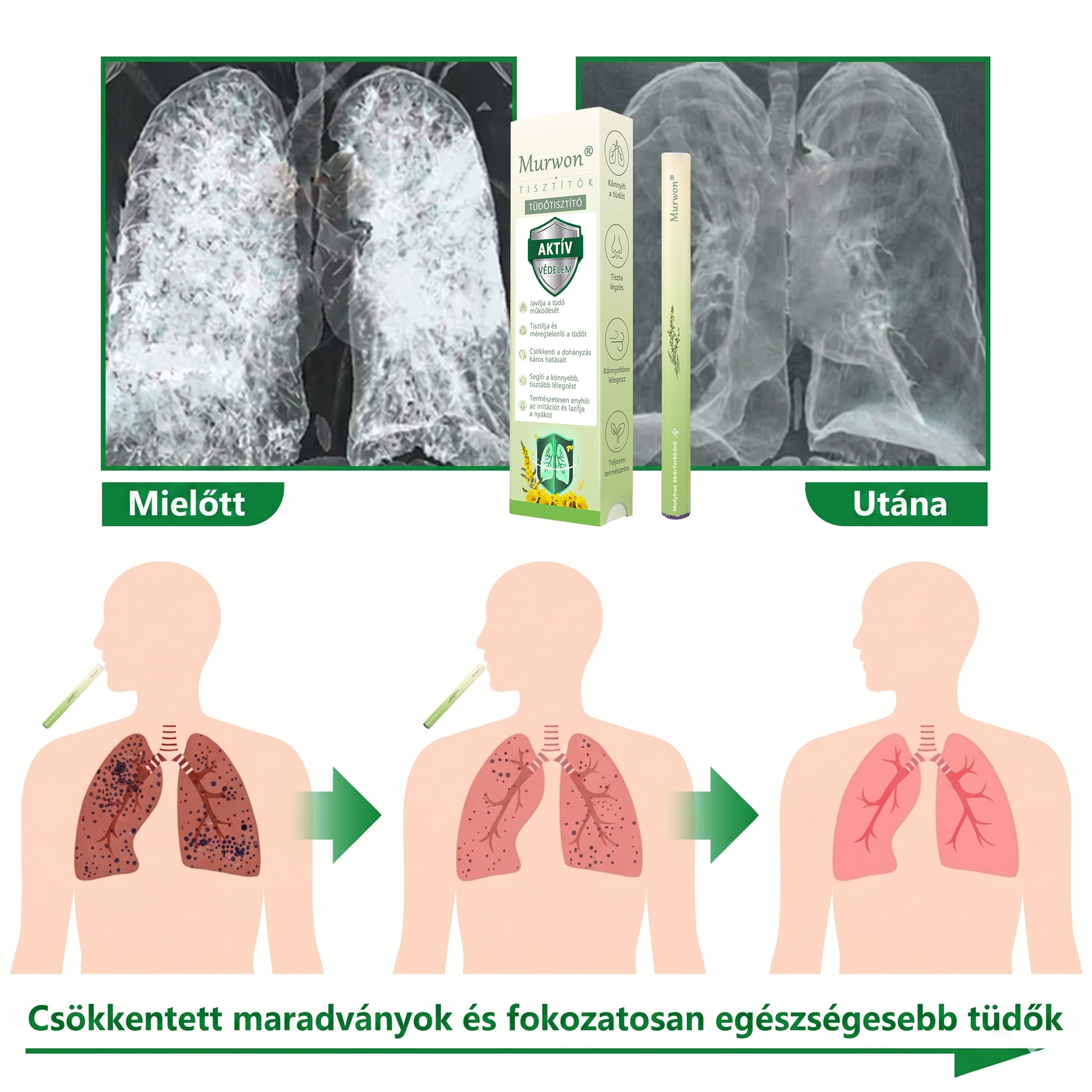 🇭🇺 High-Quality Hungarian Product with Domestic Shipping 🥇 Murwon® Herbal Lung-Cleansing Diffuser 🧄(👨‍⚕️ Effective Help for Cough, Sore Throat, Shortness of Breath, Mucus, Nasal Congestion, Bronchitis, Allergy Symptoms and Lung Problems) ❤️
